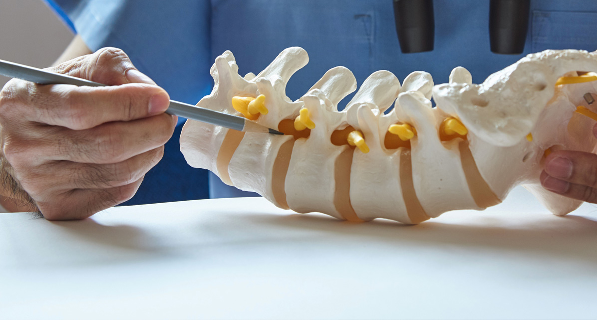Managing Life with Spinal Stenosis